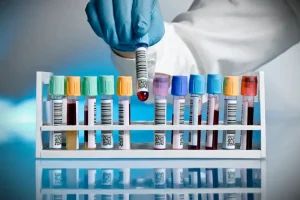 Drug Testing is Essential for Every Driver